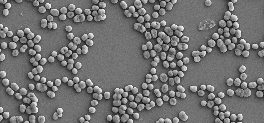Acinetobacter baumannii-The Superbug research
