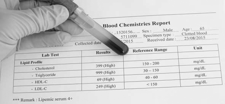 Advanced markers for lipid testing 
