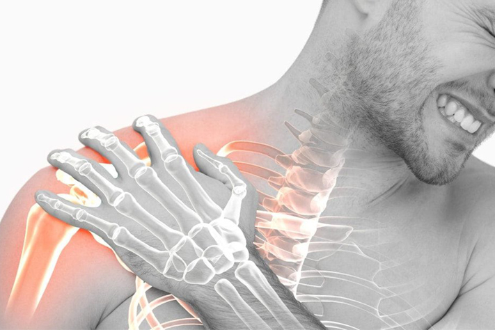 DONâ€™T DISCOUNT A FROZEN SHOULDER