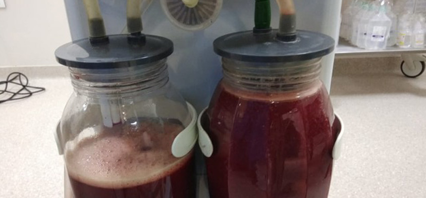 3 Liters of Blood Loaded in 55 Year Old Female Abdomen due to Ruptured in Ovarian