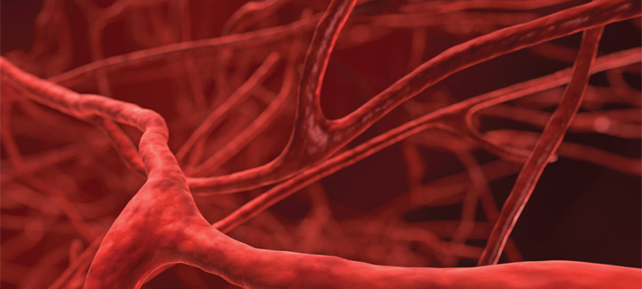 Blood Vessel Blockages Can Be Reversed With The Right Measures