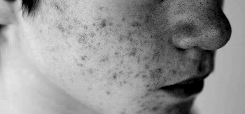 Drugs meant to cure illness Could cause allergic reactions