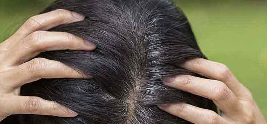 Facts about premature greying of hair 