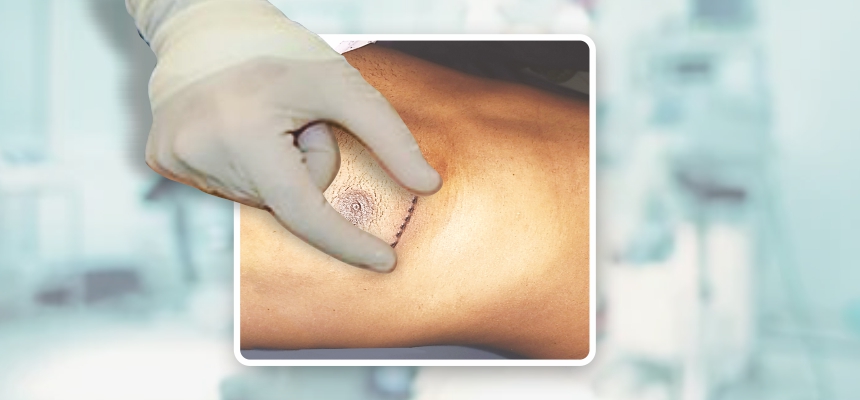 Minimally Invasive Surgery For Quick Recovery, Excerpts from the insightful interview with Dr. Gopichand Mannam