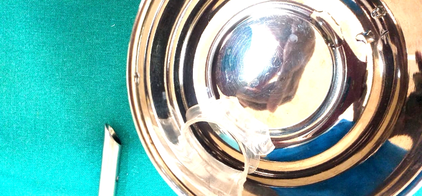 Doctors from Wockhardt Hospital Remove 1.5 Inch Bottle Cap Stuck in Infants Throat