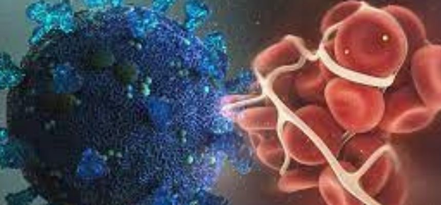 Blood clots occurring in severe Covid 19 cases