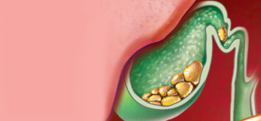 It's a stony feeling