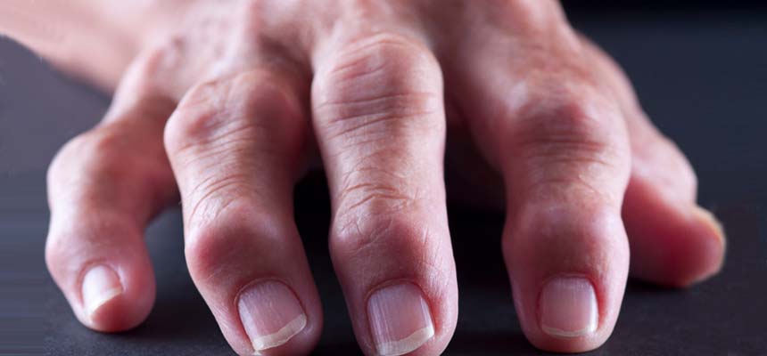 Bone health requires exercise and proper diet