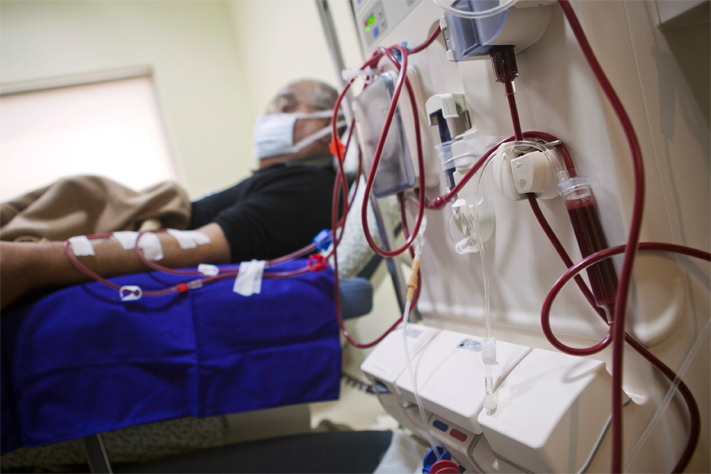 Free Dialysis Centers To Become A Norm Across Telangana
