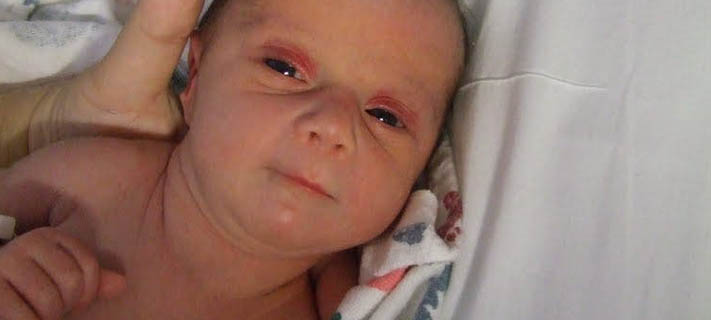 NDMC to treat children for anemia 