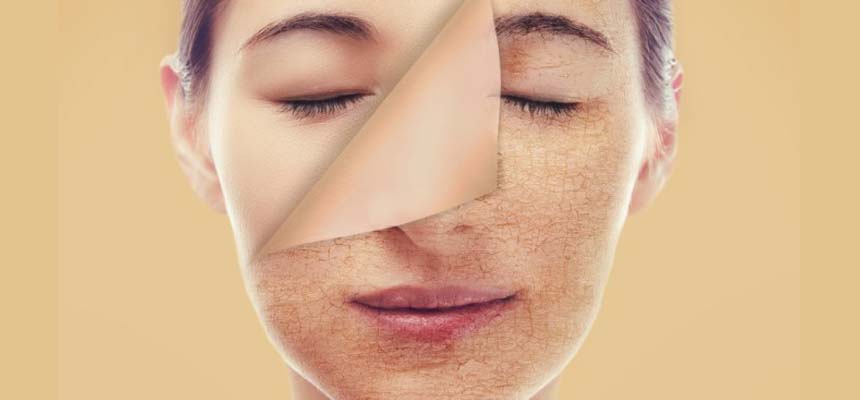 Drive away dry skin !