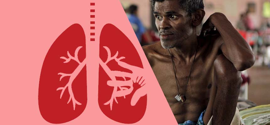 On World TB Day; letâ€™s join hands to beat TB