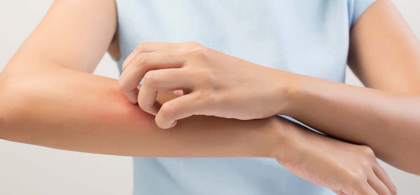 Enjoy this Summer Season Without Rashes, Allergies and Infections