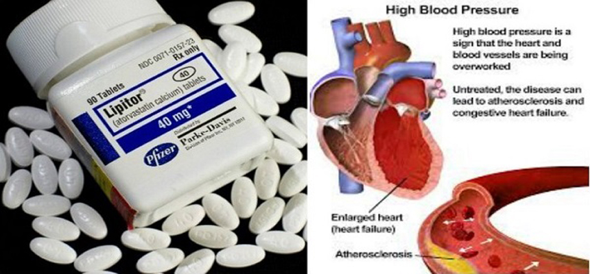 Did you know that Cholesterol medications could treat blood cancer?