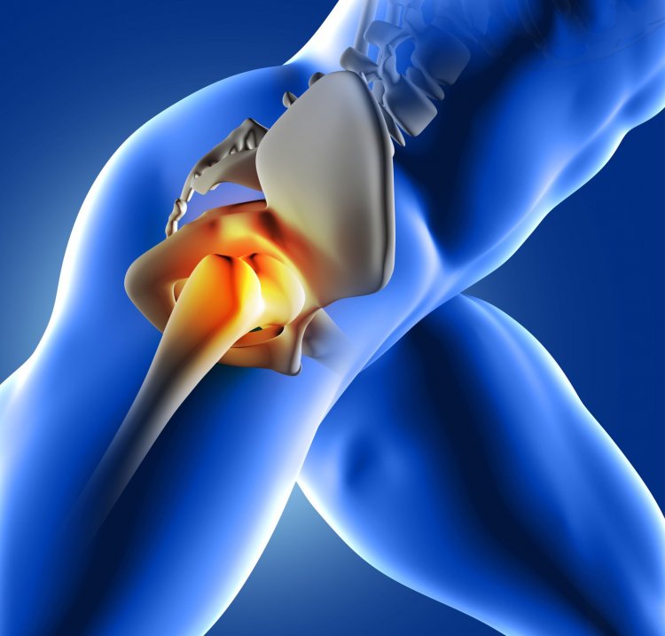 REALITY CHECK ON KNEE REPLACEMENT SURGERY