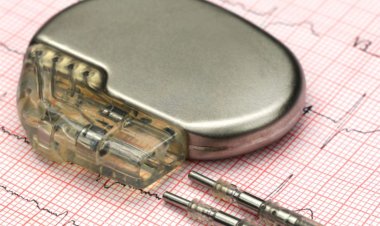 UNDERSTANDING HEART PACEMAKERS
