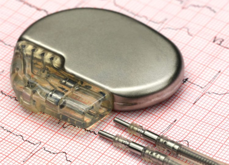 UNDERSTANDING HEART PACEMAKERS