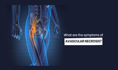 A Surge In Avascular necrosis In Post-Covid Patients