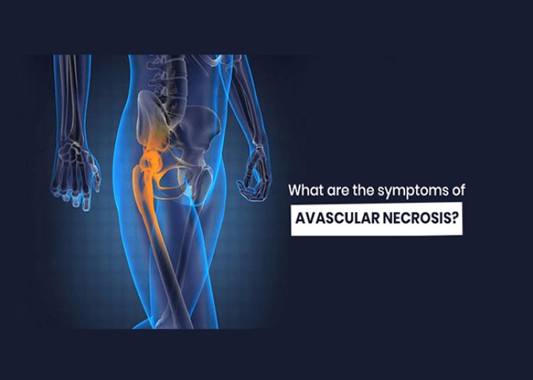 A Surge In Avascular necrosis In Post-Covid Patients
