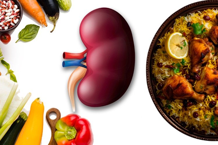 Impact of vegetarian and non-vegetarian diets on kidney stones, Its Prevention & Treatment