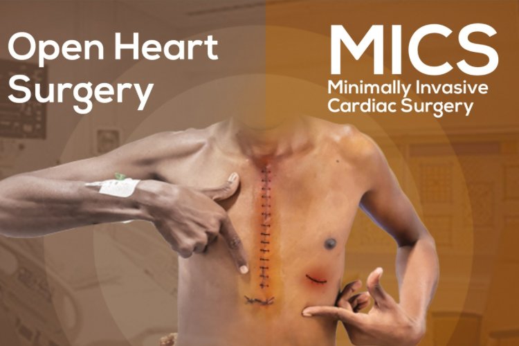 Transforming Heart Care: A Traveler’s Guide to Minimally Invasive Cardiac Surgery