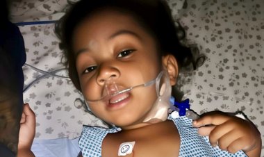 Star Hospitals Saves 1.5-Year-Old Baby of 7 Kg with Pancreatic Duct Leakage Problem