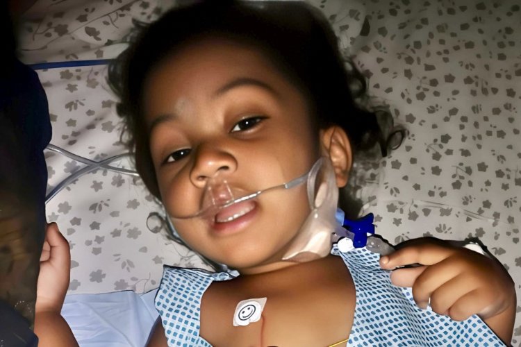 Star Hospitals Saves 1.5-Year-Old Baby of 7 Kg with Pancreatic Duct Leakage Problem