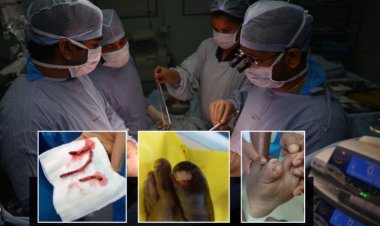 CARE Hospitals, Malakpet Gives 67-Year-Old a Second Chance to Walk